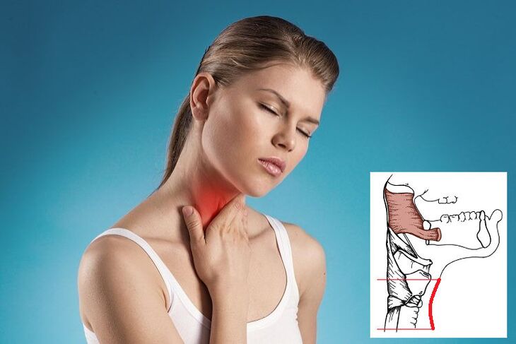 Dor de garganta con osteocondrose cervical por compresión nerviosa