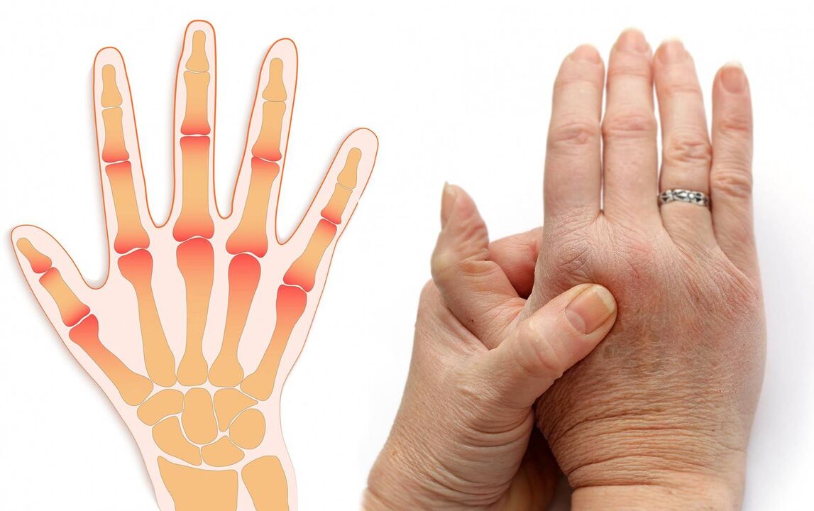 enfermidades dos dedos