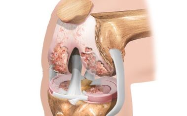 Esquema dos ligamentos