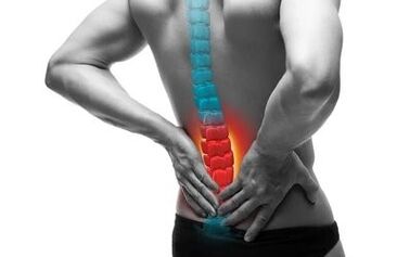 A osteocondrose é unha enfermidade da columna vertebral